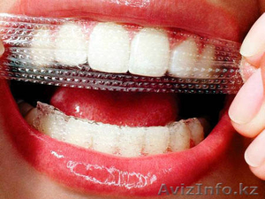 Отбеливающие полоски для зубов - Изображение #1, Объявление #1570118