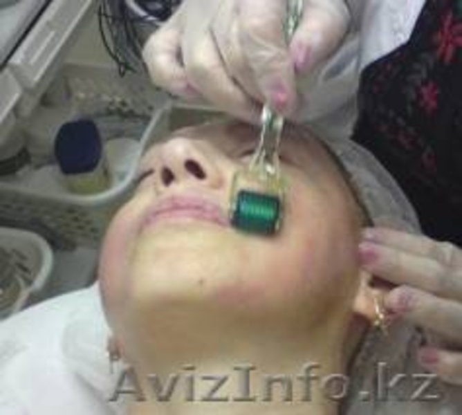 мезотерапия , биоревитализация - Изображение #3, Объявление #558050