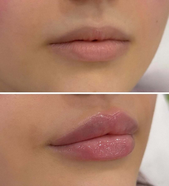 Красота начинается с заботы о себе! - Изображение #2, Объявление #1752000